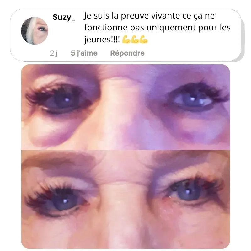 Eralia RedLight Pads™